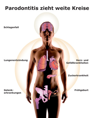 Parodontaltherapie